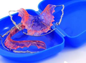 5 Signs It’s Time to Replace Your Retainer