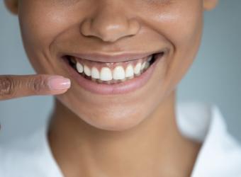Gum Disease: A "Sneaky" Yet Preventable Health Issue