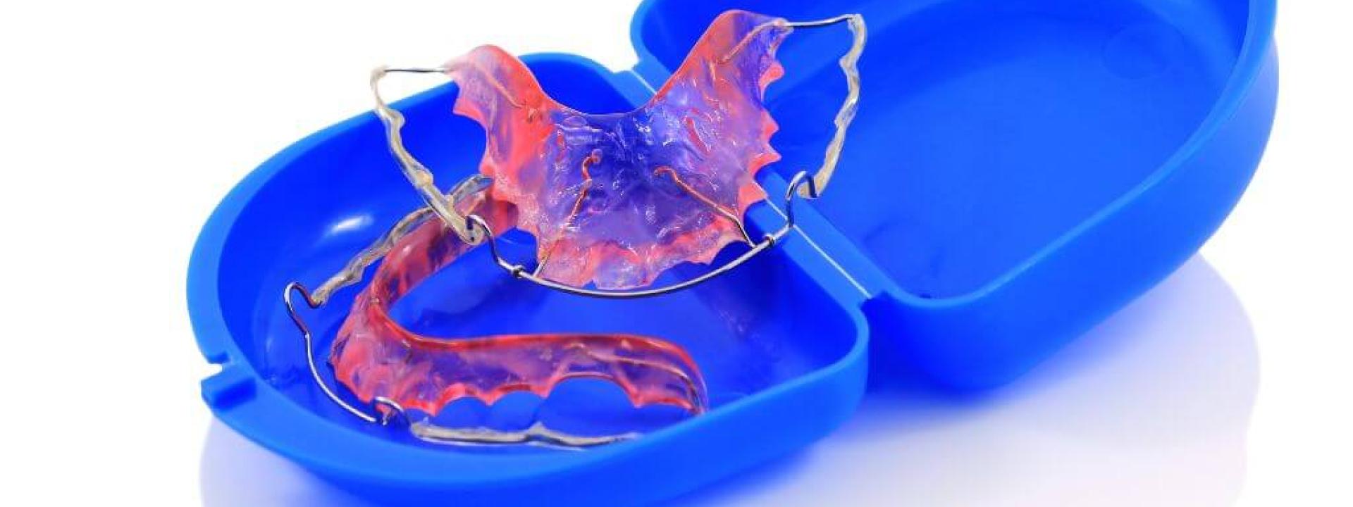 5 Signs It’s Time to Replace Your Retainer