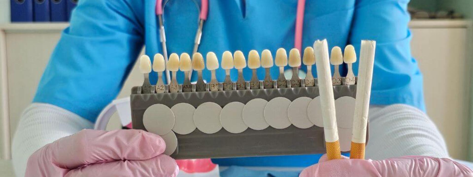 Teeth discoloration due to smoking chart.